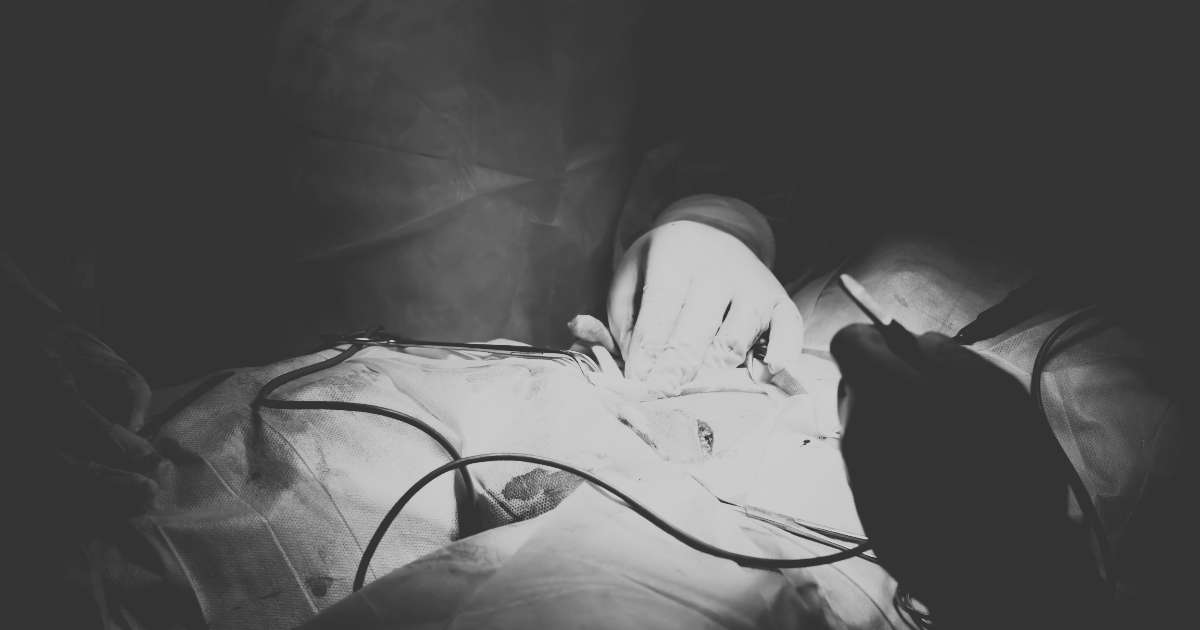 A photo of Titan Penile Implant surgery.